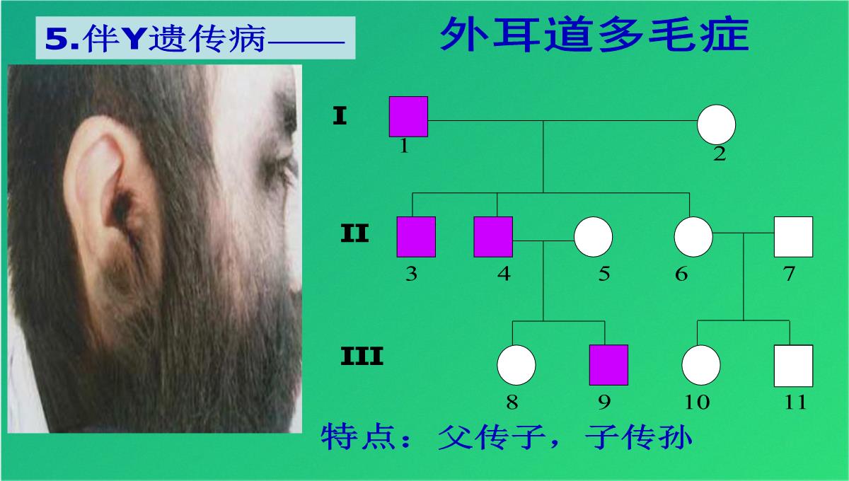 高三人教伴性遗传(共47张PPT)PPT模板_24