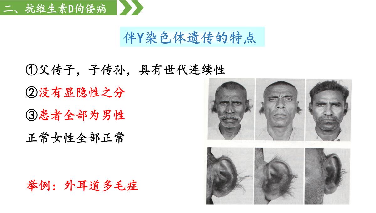 伴性遗传课件高一下学期生物人教版必修2PPT模板_32